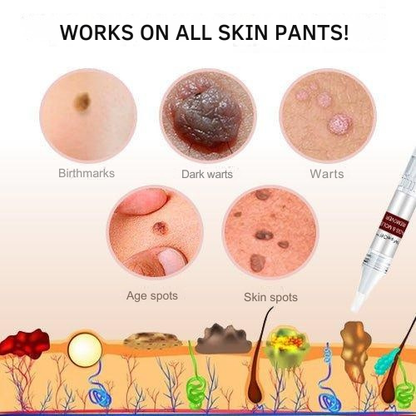 Plant-Based Wart and Skin Spot Remover Pen with Precision Applicator