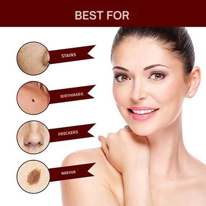 Plant-Based Wart and Skin Spot Remover Pen with Precision Applicator