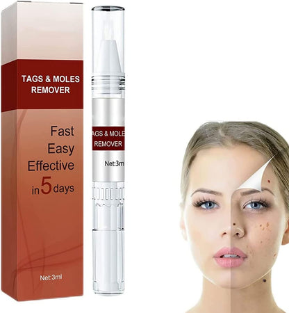 Plant-Based Wart and Skin Spot Remover Pen with Precision Applicator